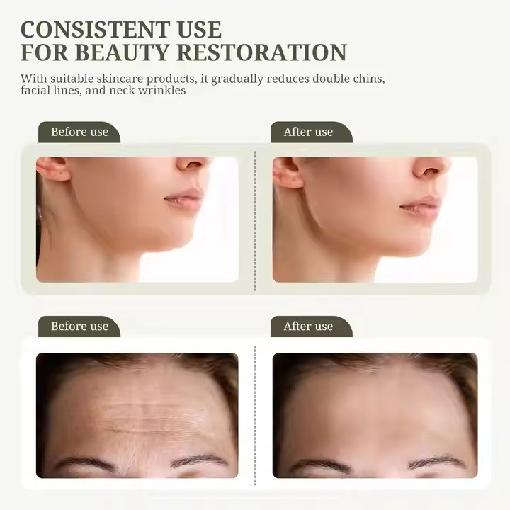  Máquina de estiramiento facial con terapia LED, instrumento de masaje de cuello y belleza 