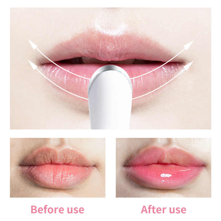 Dispositivo de cuidado de belleza, herramienta eléctrica para rellenar labios 